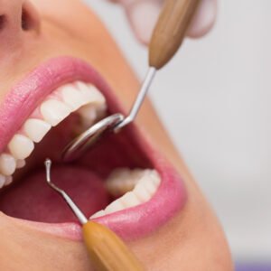 Limpieza Dental Profesional