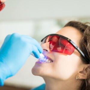 Blanqueamiento Dental LED