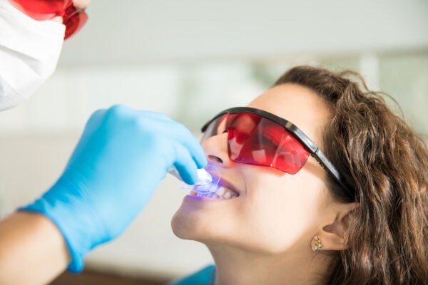 Blanqueamiento Dental LED