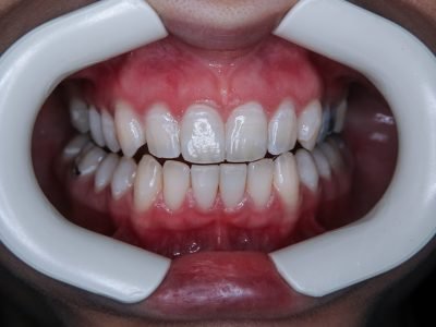 Clínica Dental en Barcelona