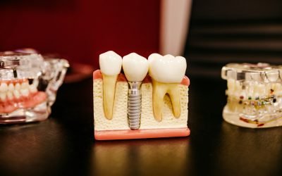 Photo by Jonathan Borba Nosotros - Clínica Dental en Barcelona