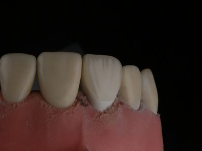 Clínica Dental en Barcelona